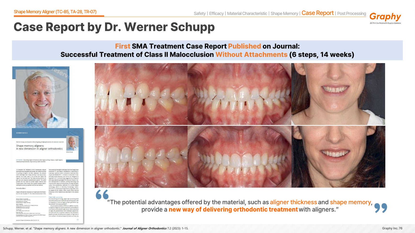 Published shape-memory aligner clinical case